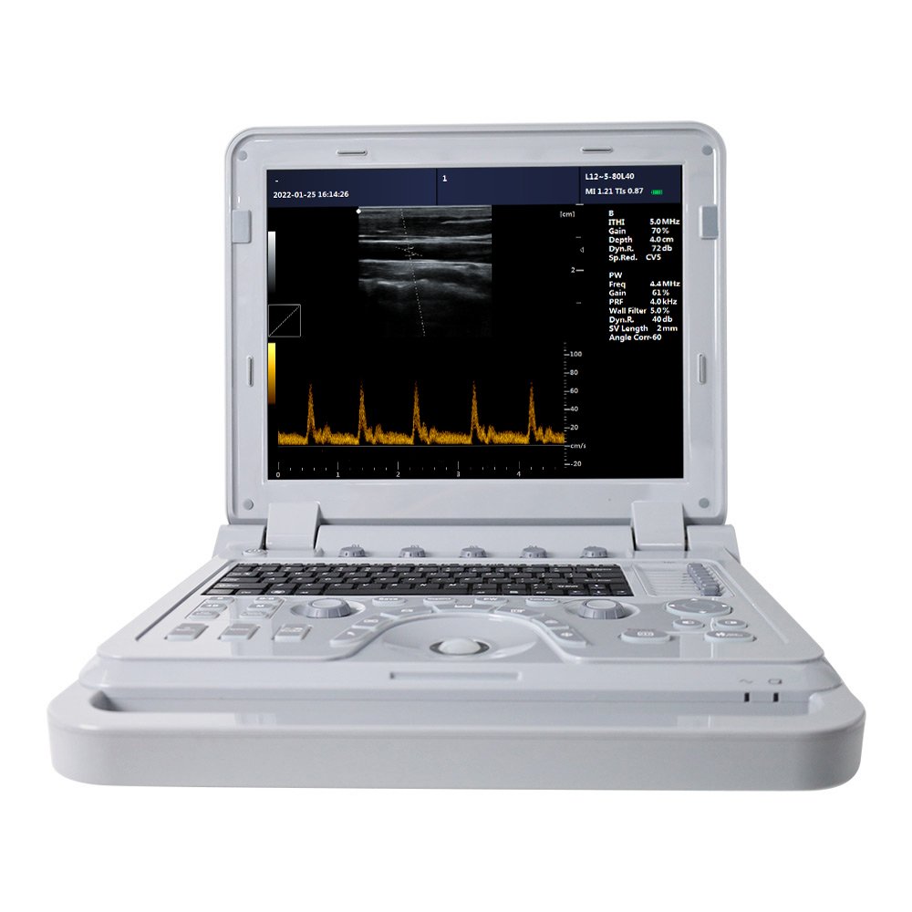 CONTEC CMS600P2 PLUS ultrasound pseudo color doppler ultrasound Pulse Spectral ultrasound