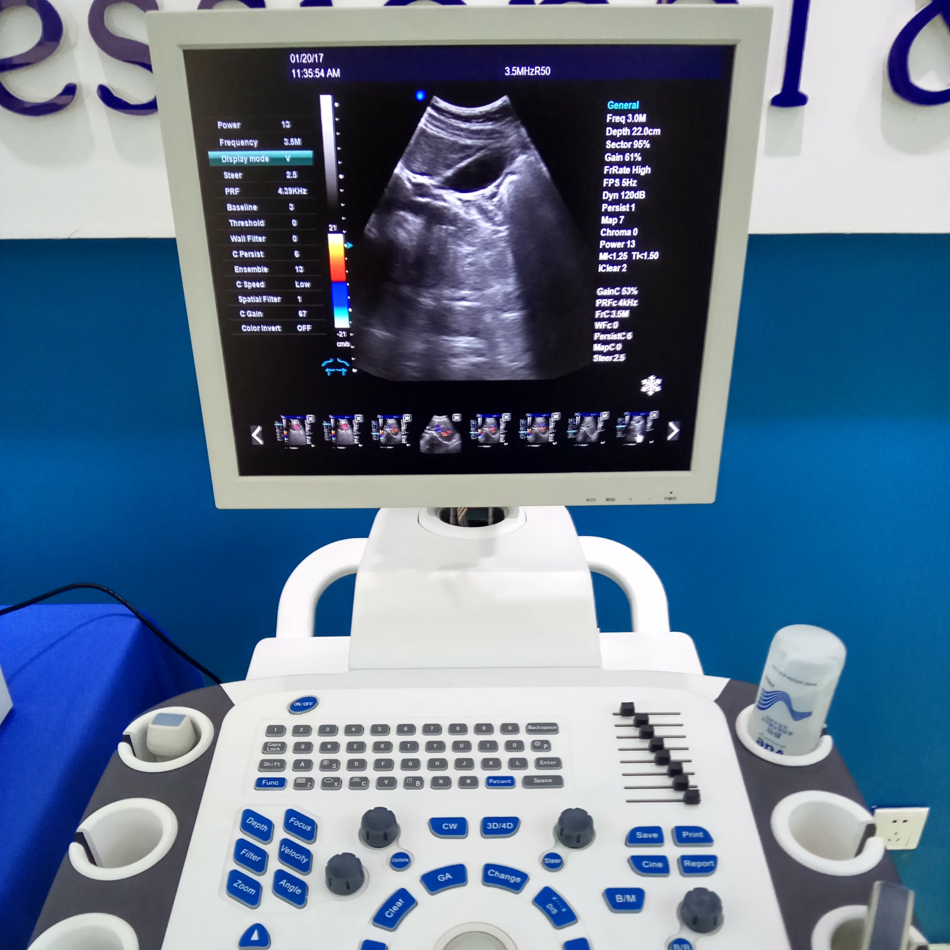 DAWEI DW-VET9 Ver.Pioneer Trolley doppler Veterinary Ultrasound Pets hospital