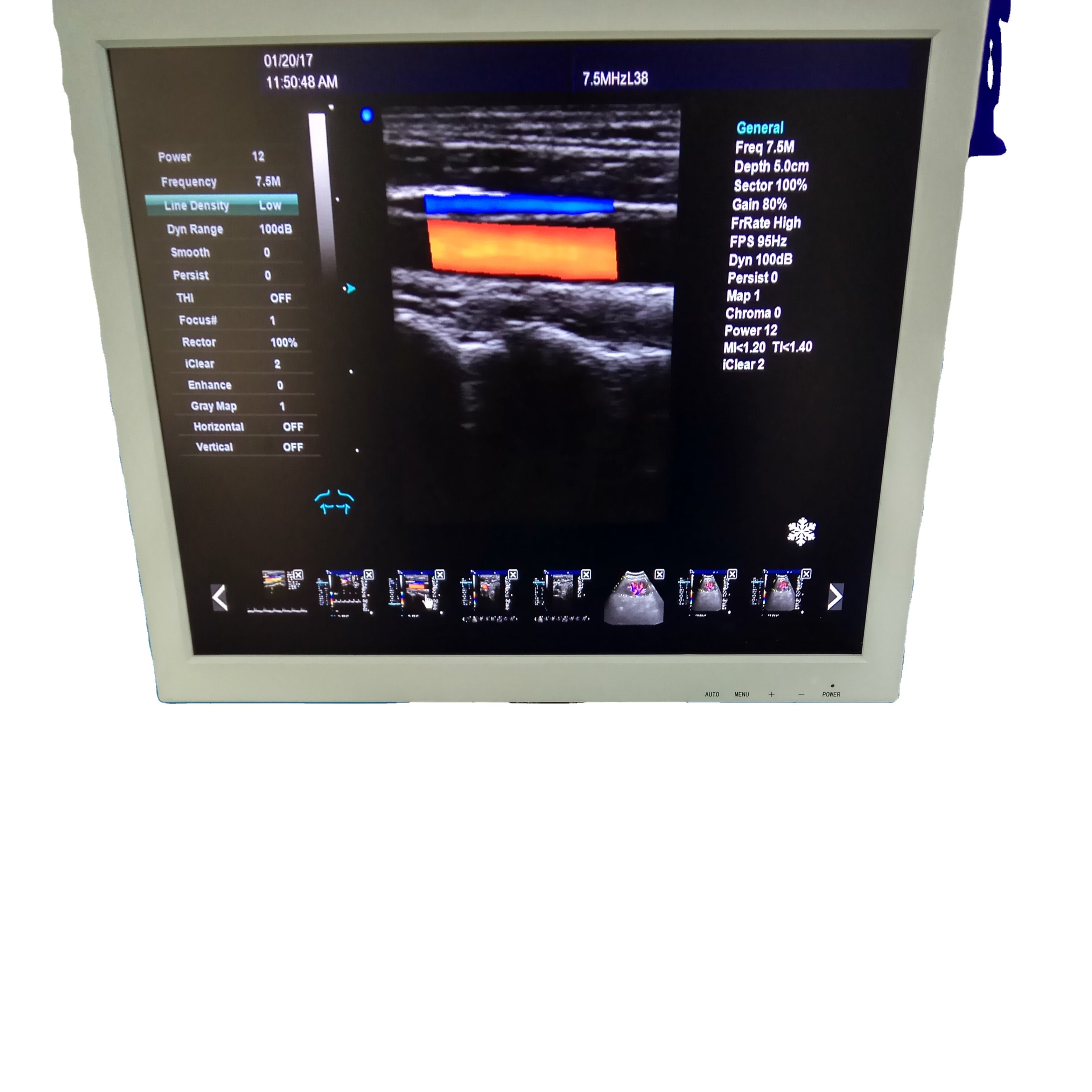 DAWEI DW-VET9 Ver.Pioneer Trolley doppler Veterinary Ultrasound Pets hospital