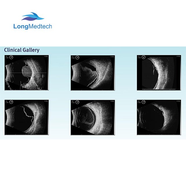 12.1 Inch Touch Screen Medical Ophthalmology Equipment Ophthalimic AB Ultrasound Scanner