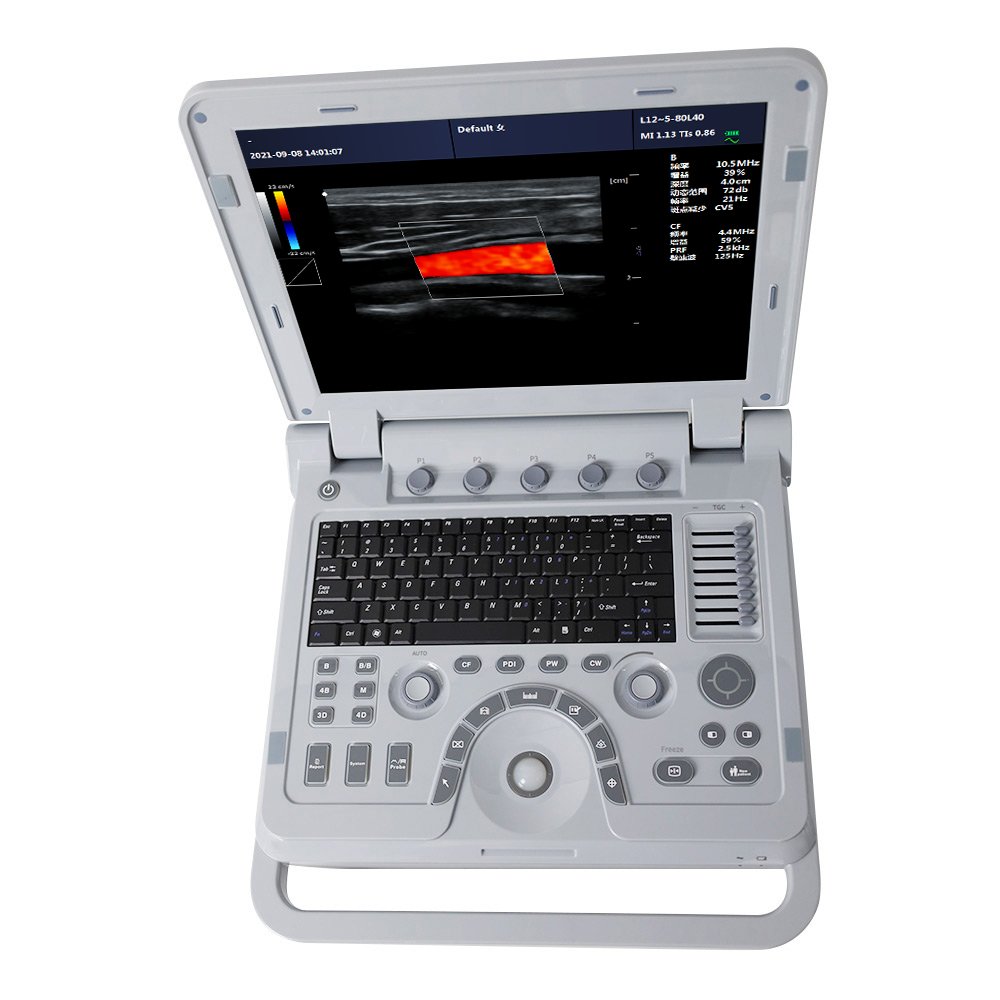 CONTEC CMS1700A ultrasonic medical foetal doppler ultrasound instruments eco doppler