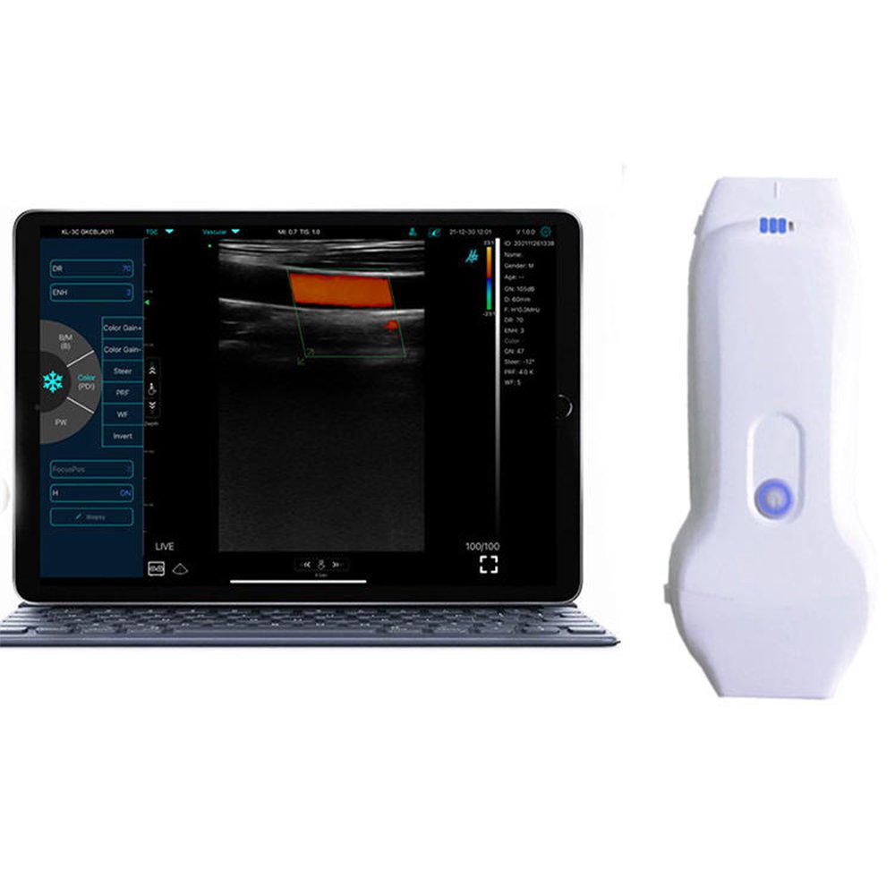 Portable wireless ultrasound probe/ WIFI handheld ultrasound MSLPU41