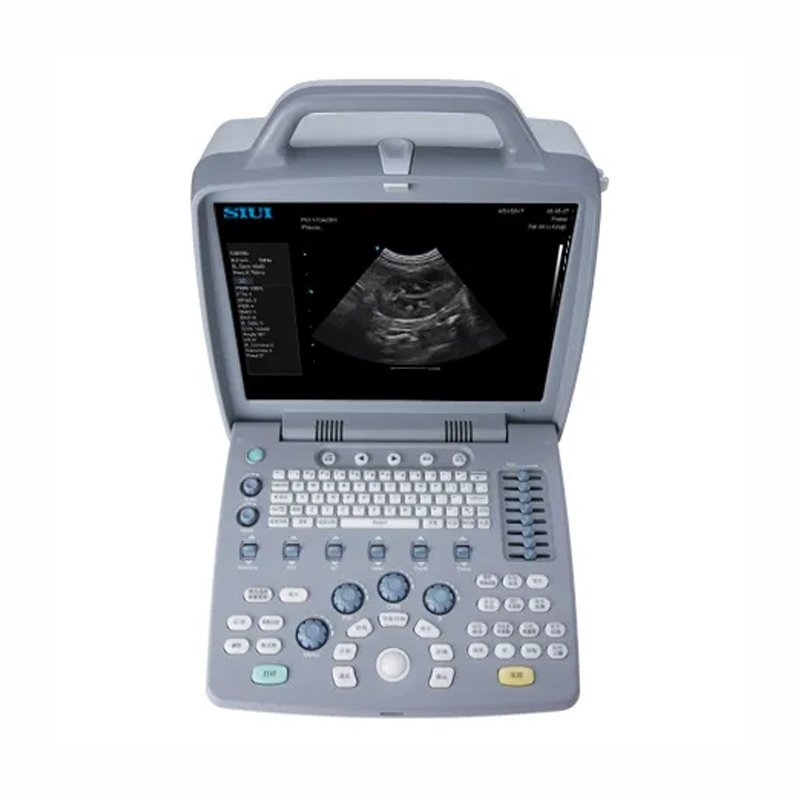 SIUI CTS-8800V Plus Upgraded on the new generation platform lap-top veterinary ultrasound medical ultrasound instruments