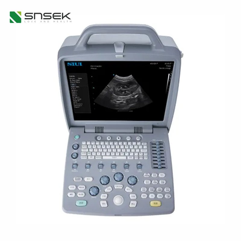 SIUI CTS-8800V Plus Upgraded on the new generation platform lap-top veterinary ultrasound medical ultrasound instruments