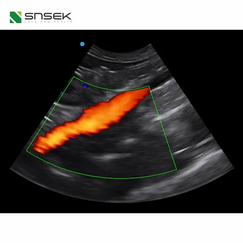 SIUI CTS-8800V Plus Upgraded on the new generation platform lap-top veterinary ultrasound medical ultrasound instruments