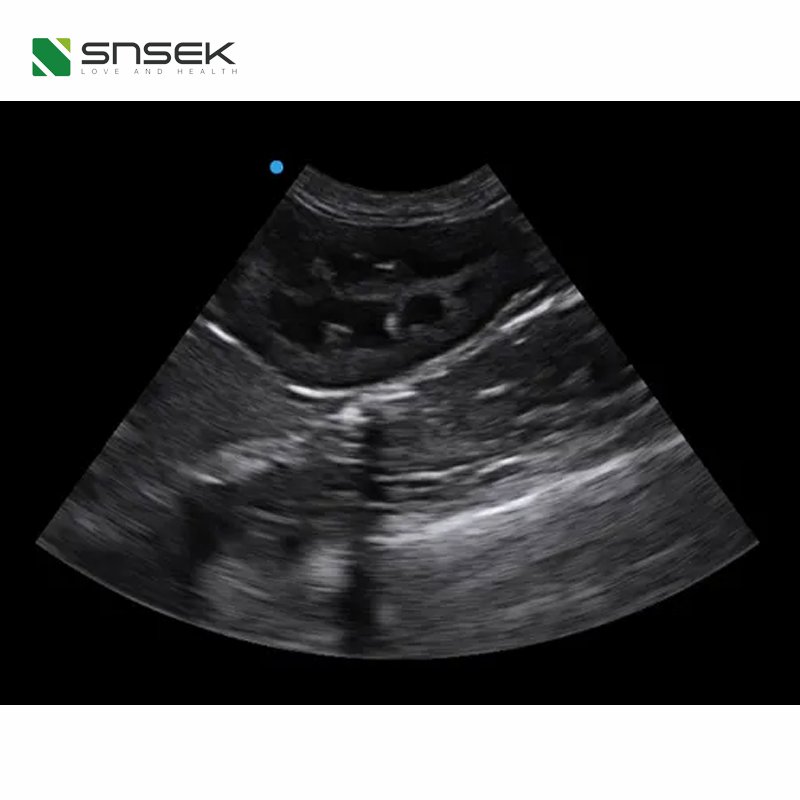 SIUI CTS-8800V Plus Upgraded on the new generation platform lap-top veterinary ultrasound medical ultrasound instruments