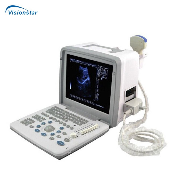 UBW300 Factory Price Portable B/W Ultrasound Scanner Machine with 5 Display Modes for Human Use