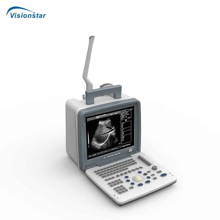UBW300 Factory Price Portable B/W Ultrasound Scanner Machine with 5 Display Modes for Human Use