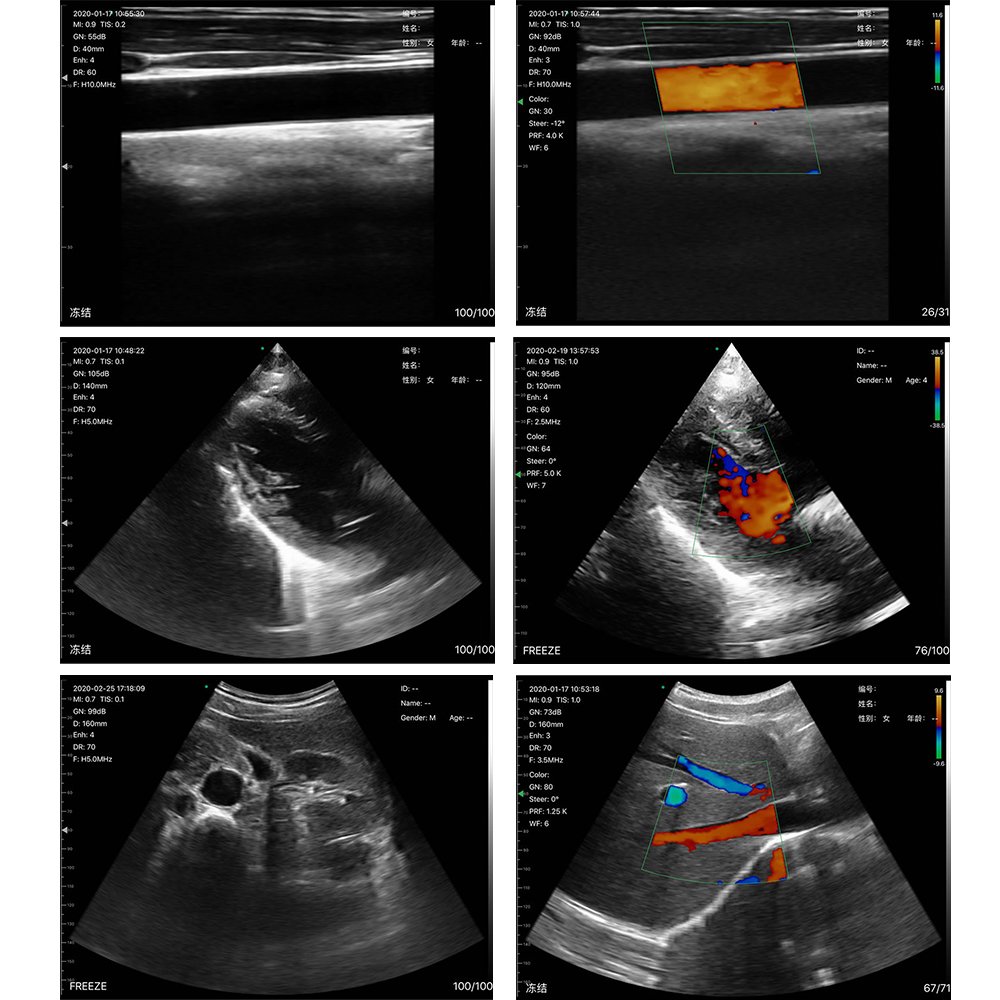 Wireless Medical Ultrasound Probe Portable and Convenient for Diagnostic Imaging MSLAA114