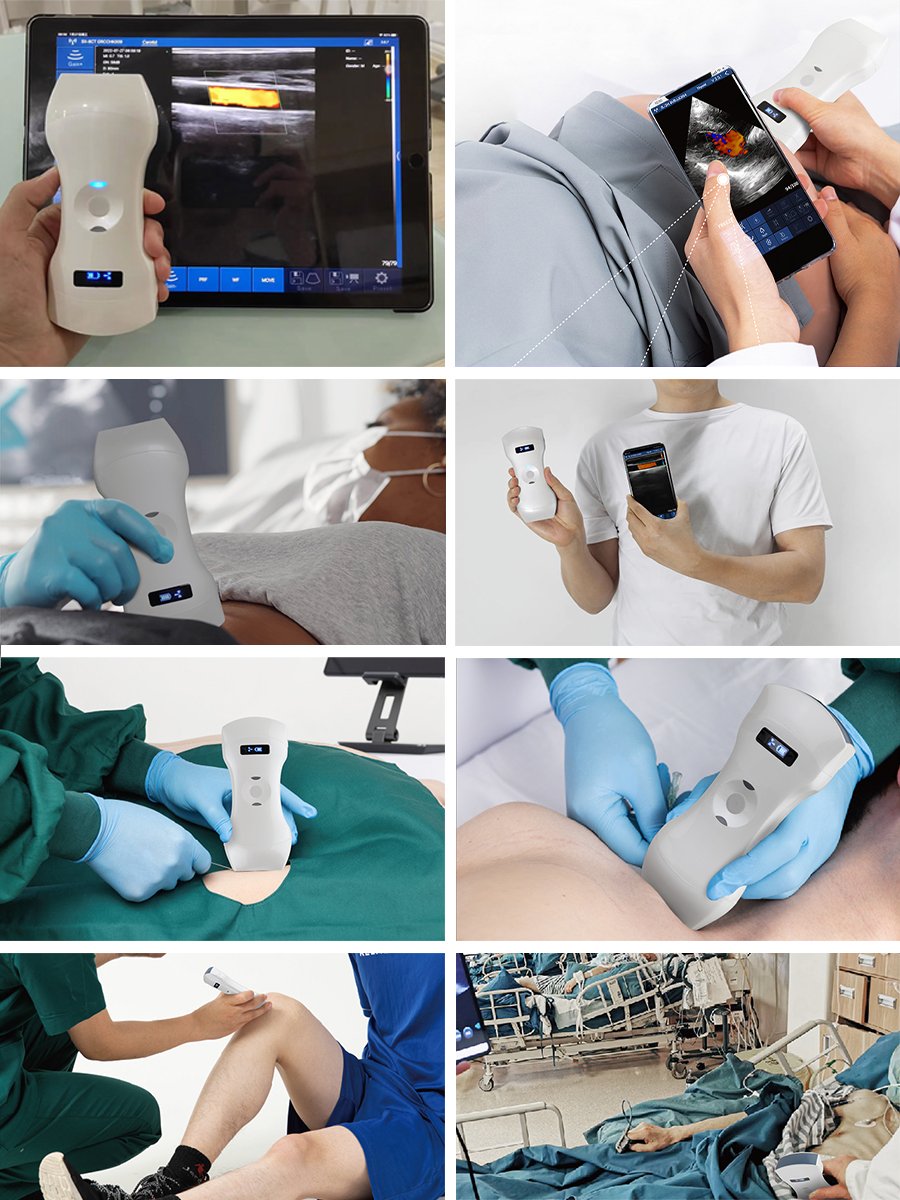Wireless Medical Ultrasound Probe Portable and Convenient for Diagnostic Imaging MSLAA114