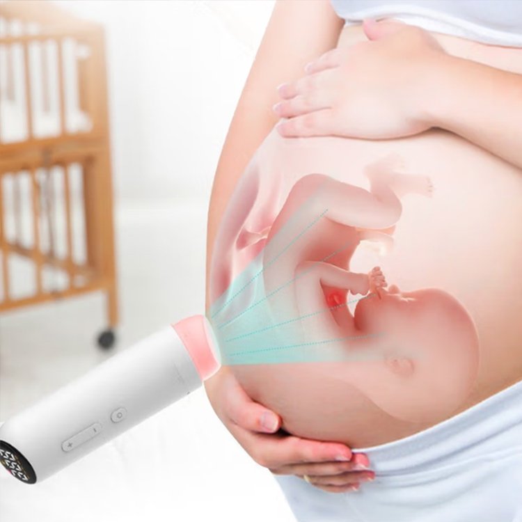 Manufacturers Wholesale Portable Doppler Fetal Detector Pregnancy Pregnant Baby Heart Rate Monitor Fetal Doppler LED