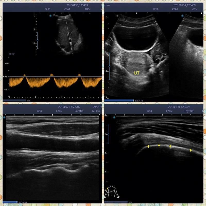 Medical ultrasound instruments 4d ultrasound machine ultrasound mindray