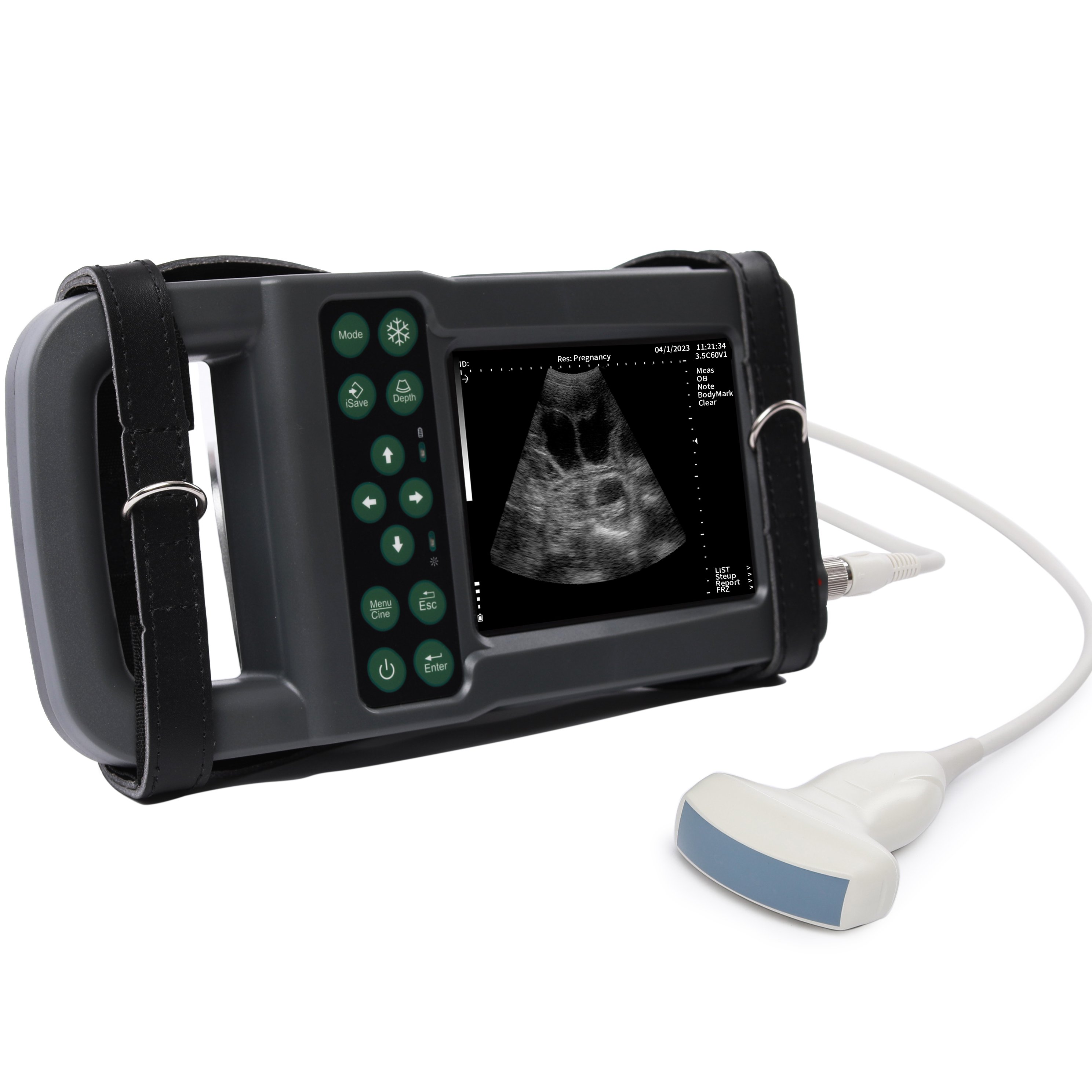 Portable Full Digital Veterinary Medical Ultrasound Instrument for Sheep Canine Dog Pig for Small Animal Practice