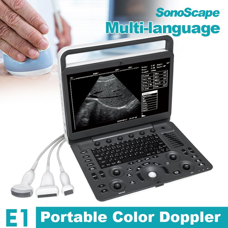 Sonoscape E1 E2 medical ultrasound instruments 4d ultrasound machine ultrasound