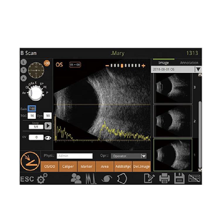 Full Digital Medical Ophthalmology A/B diagnostic ultrasound Scanner Machine Eye Test Diagnostic Instrument