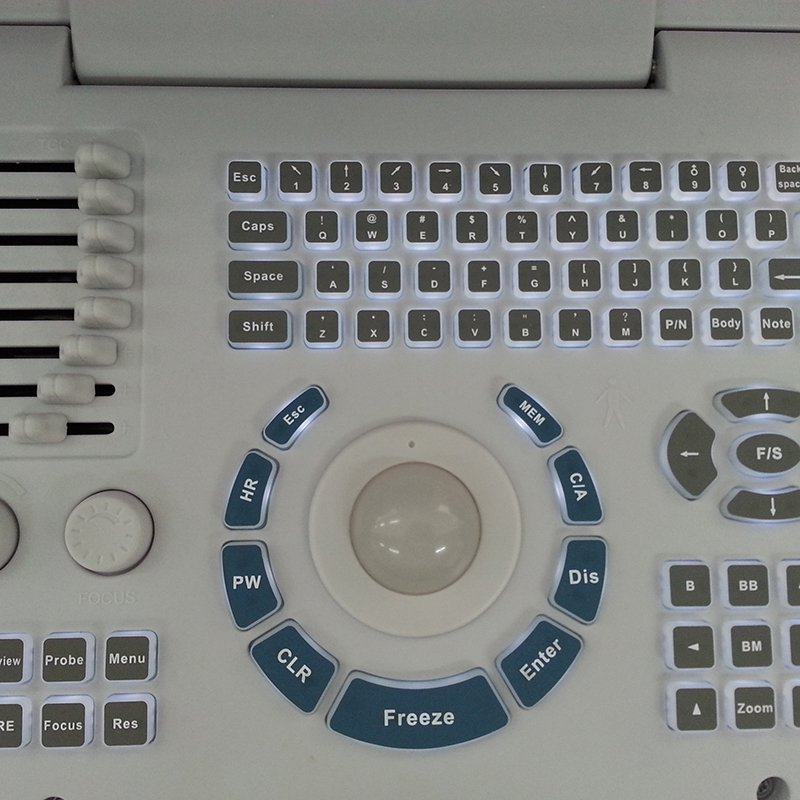 MN-S218 Medical ultrasound instruments human portable ultrasound machine ultrasound handheld device
