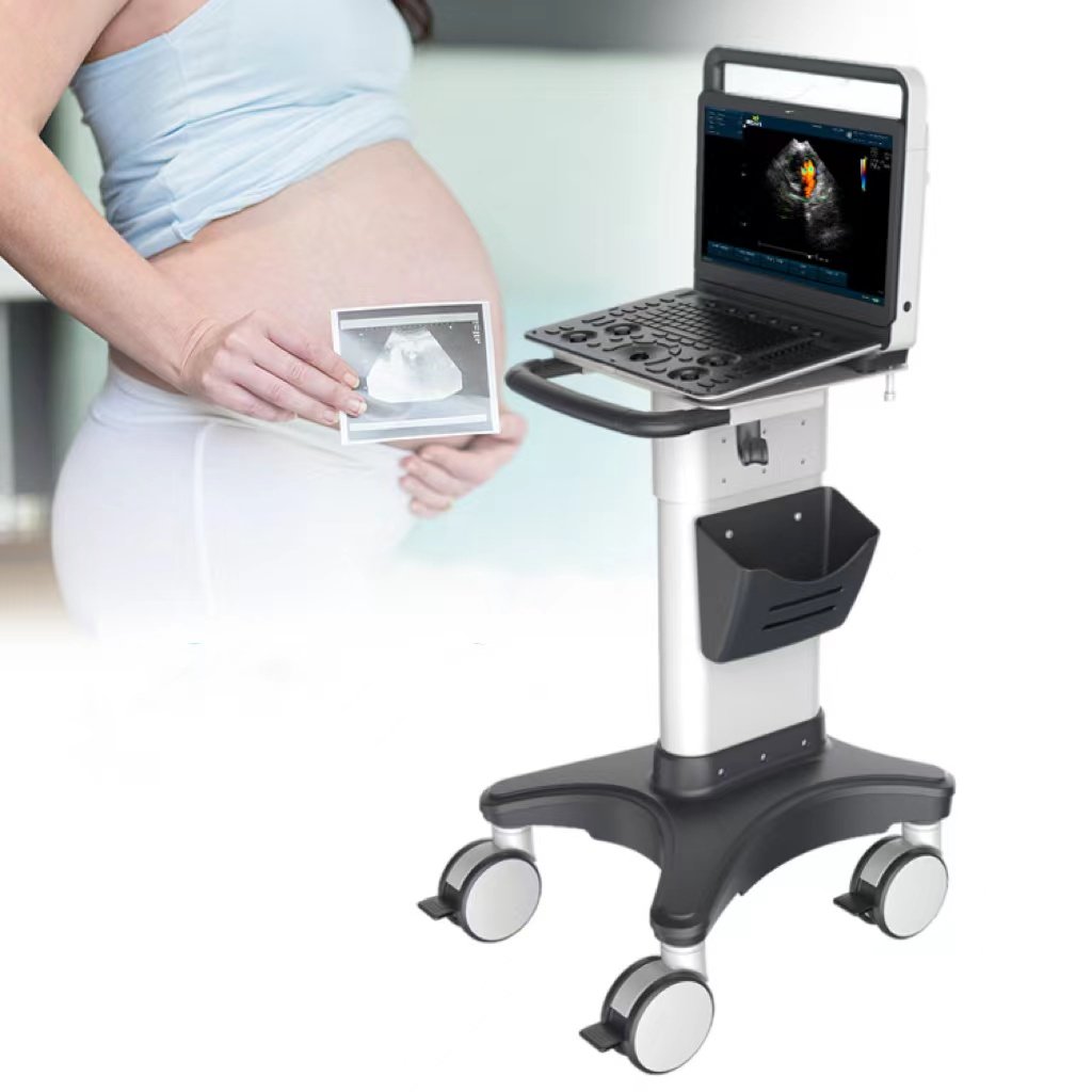 Sonoscape e2 portable echocardiography machine price physiotherapy equipment portable ultrasound scanner for sale
