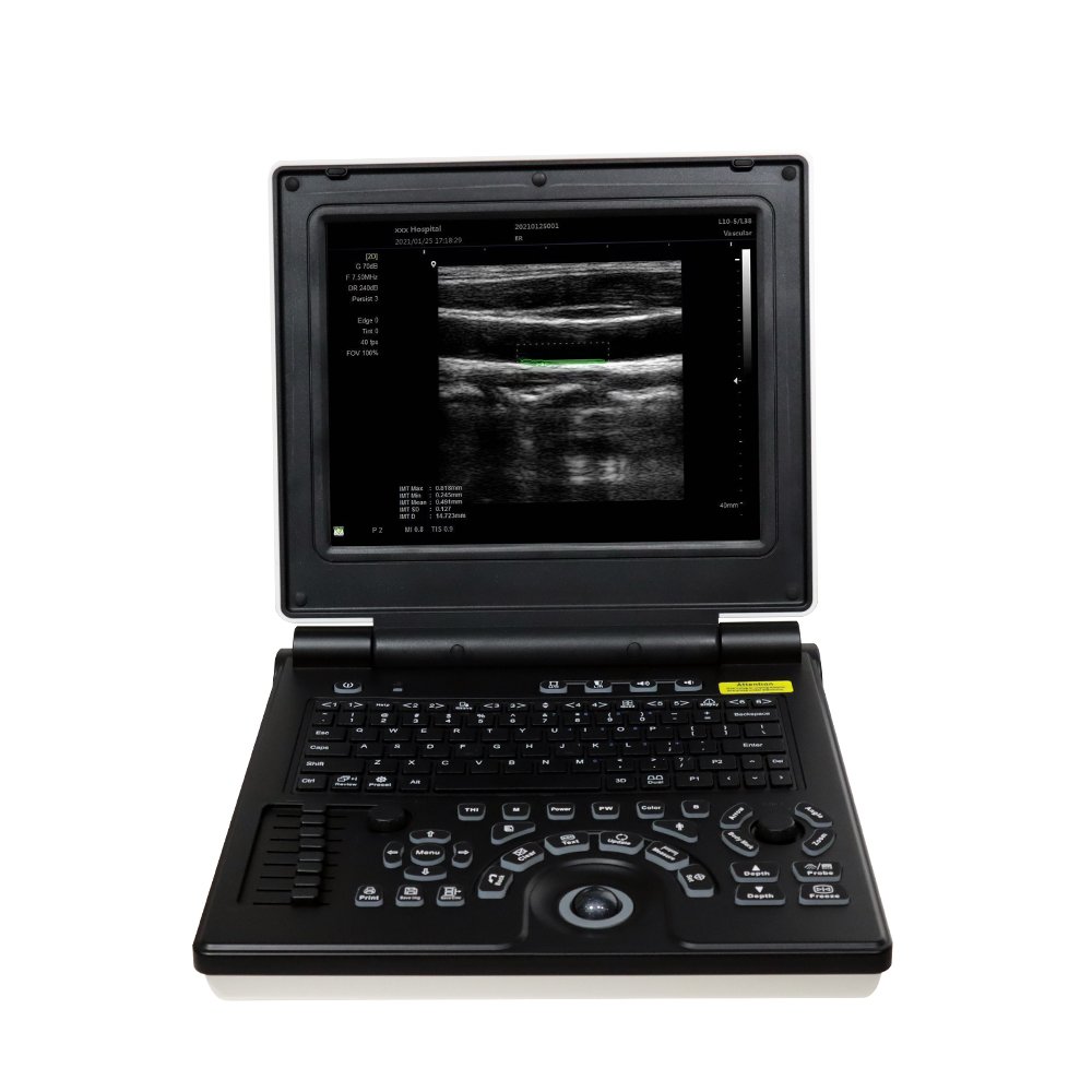 Portable veterinary instrument ultrasound medical ultrasound gel horse dopplercat dog ecocardio scanner