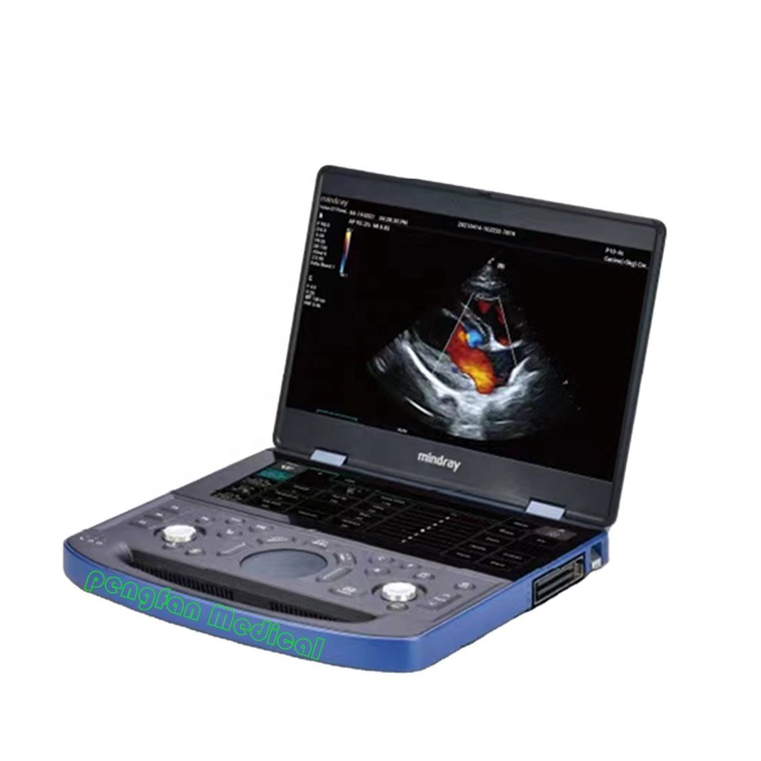 Mindray Portable Vetus E7 Color Doppler