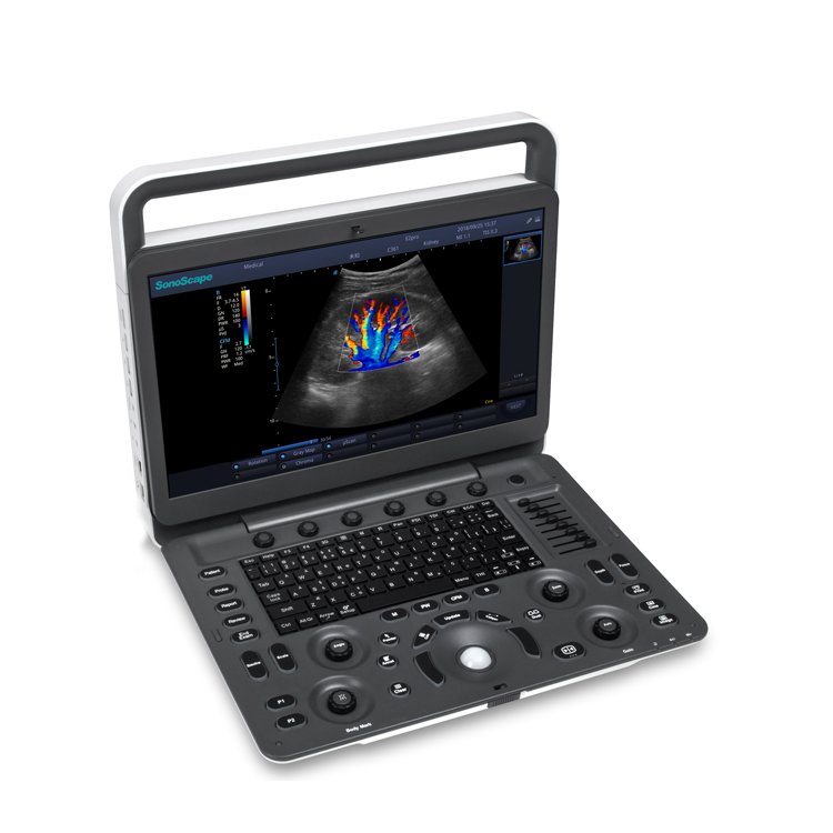 2023 Medsinglong Medical Ultrasound Instrument 3D 4D Portable Sonoscape E2 ultrasound machine price for sale