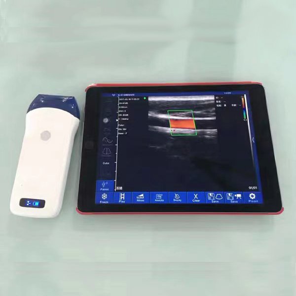 wireless 3 in 1 Wifi handheld color ultrasound instruments color Dual-head ultrasonic probe ultrasound Mindray Ultrasound
