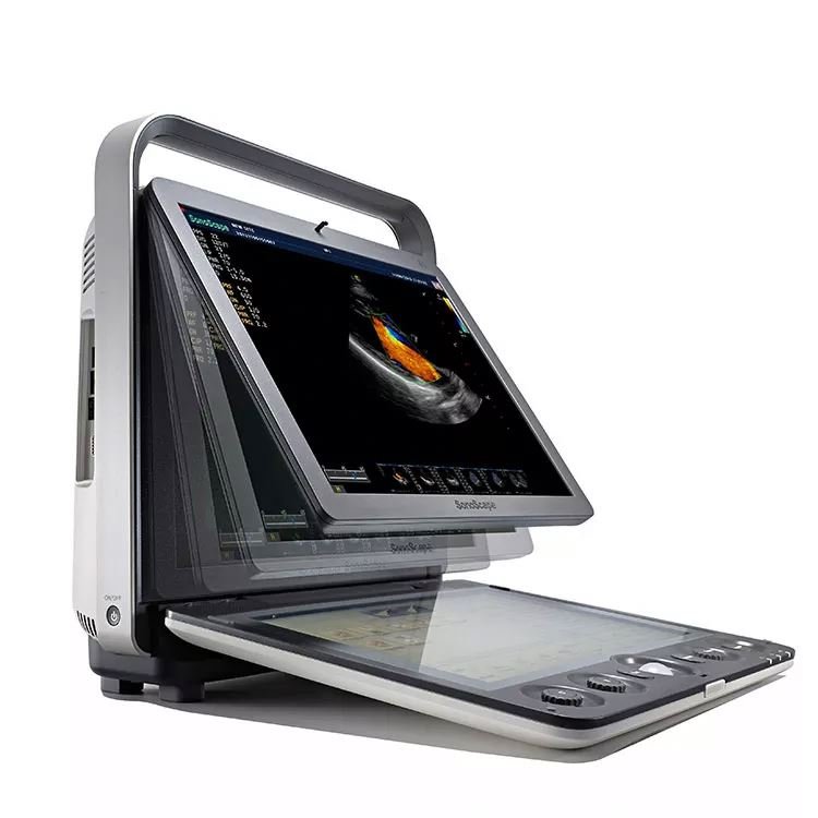 Portable Ultrasound Scanner Medical Ultrasound Instruments Famous brand Sonoscape S9 3D 4D Color Doppler Ultrasound Machine