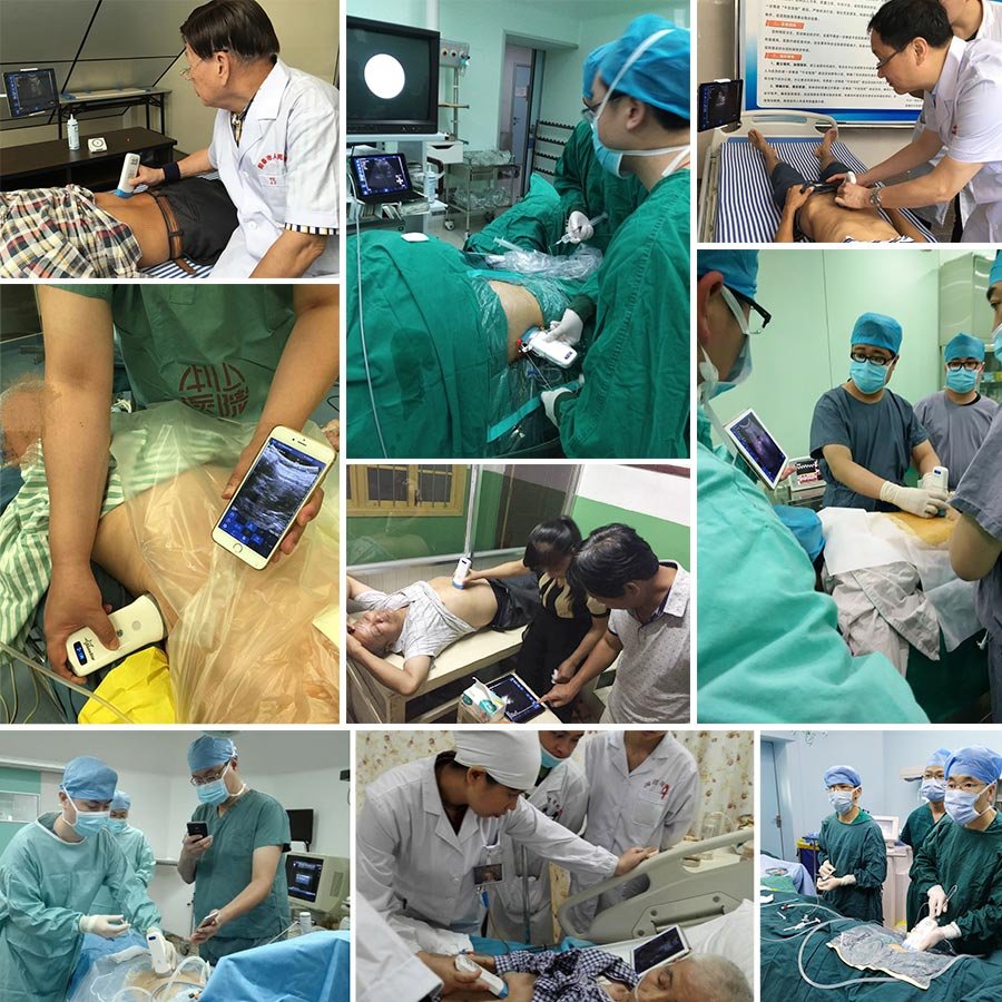OEM Double Head Linear Small Linear Micro Convex Portable Wireless Mobile Phone Ultrasound Scanner