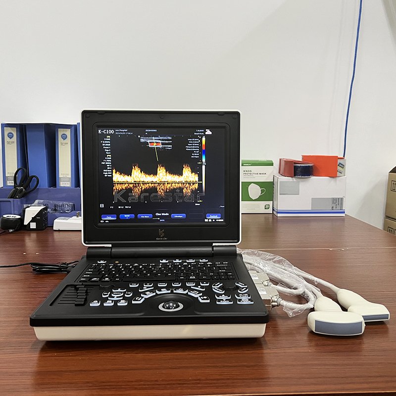 medical ultrasound veterinary instruments 3d 4d color doppler ultrasound echocardiography machine ultrasound USG