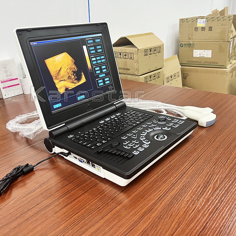 medical ultrasound veterinary instruments 3d 4d color doppler ultrasound echocardiography machine ultrasound USG