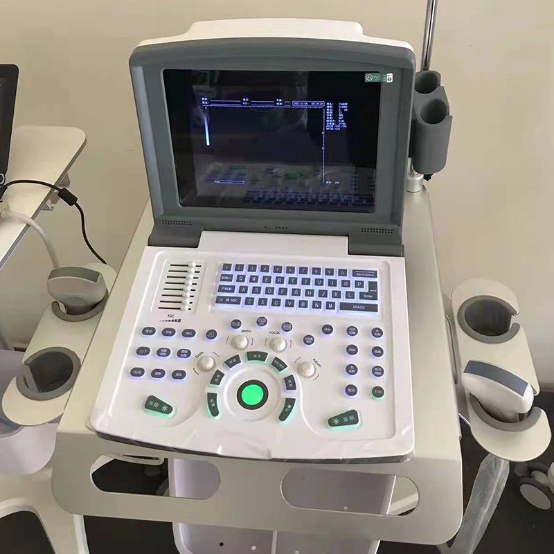 Factory Price Portable Color Doppler Ultrasound Scanner System Medical Ultrasound Instrument Laptop Ultrasound Probe
