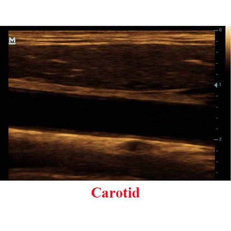 Mindray DP-20 Ultrasound Scanner Price Medical Ultrasound Instruments B/W Portable Ultrasound Machine