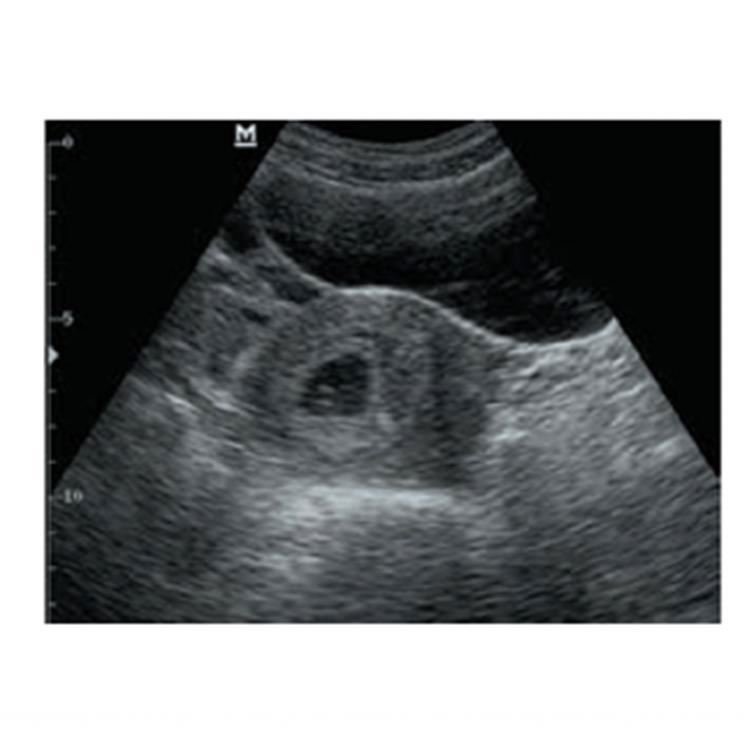 Mindray DP-20 Ultrasound Scanner Price Medical Ultrasound Instruments B/W Portable Ultrasound Machine