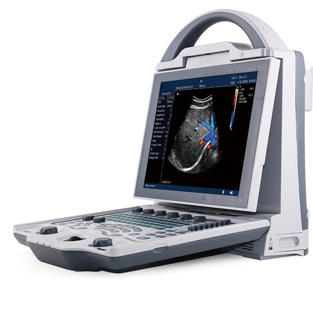 2024 new portable color ultrasound Doppler Ultrasound