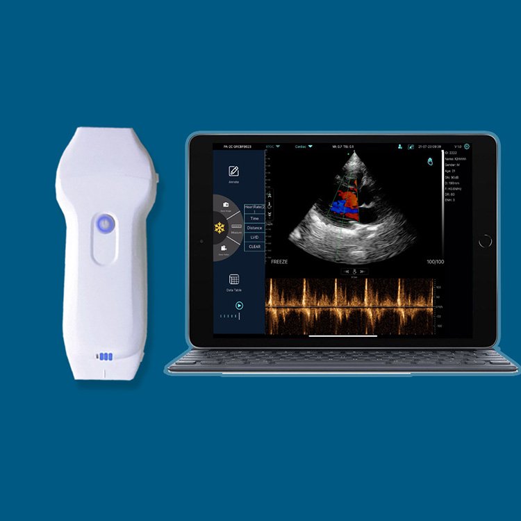 Suresult Cd2 Ultrasound Medical Ultrasound Instruments Portable Ultrasound Machine Ultrasonido Inalambrico