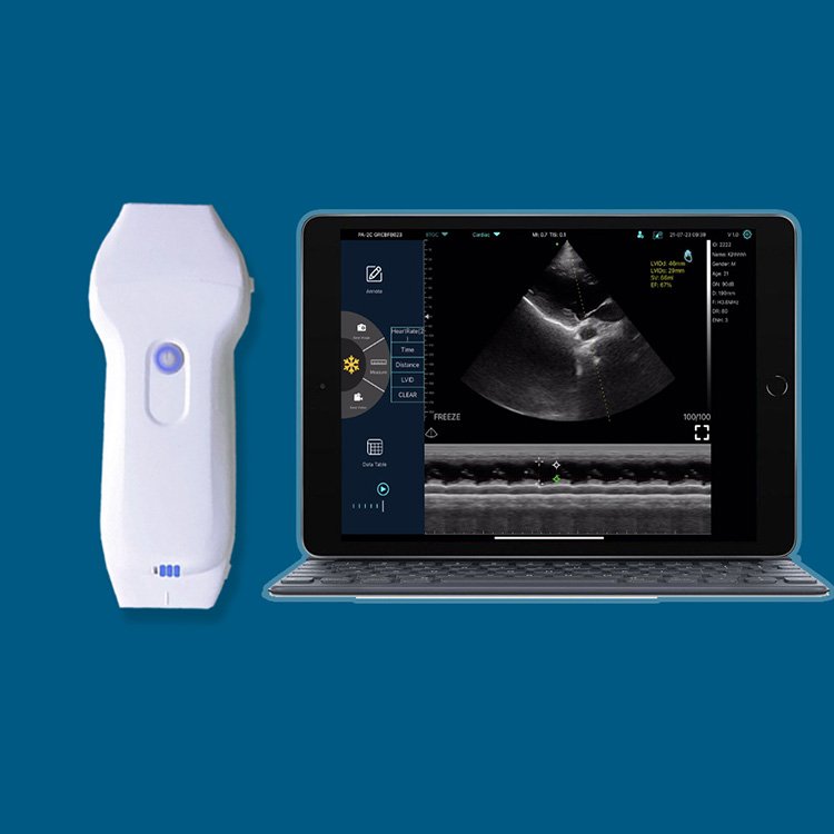 Suresult Cd2 Ultrasound Medical Ultrasound Instruments Portable Ultrasound Machine Ultrasonido Inalambrico