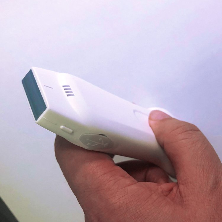 Suresult Cd2 Ultrasound Medical Ultrasound Instruments Portable Ultrasound Machine Ultrasonido Inalambrico