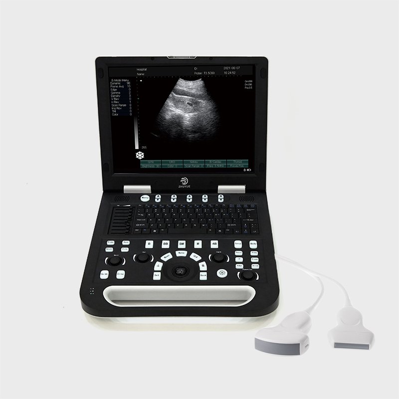 Medical Ultrasound Instrument Portable Laptop Veterinary Color Doppler Ultrasound Machine 3d LED Display Ultrasound