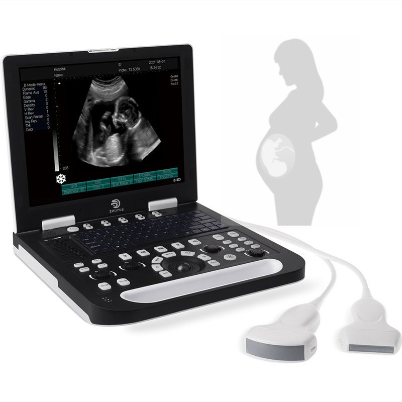Medical Ultrasound Instrument Portable Laptop Veterinary Color Doppler Ultrasound Machine 3d LED Display Ultrasound