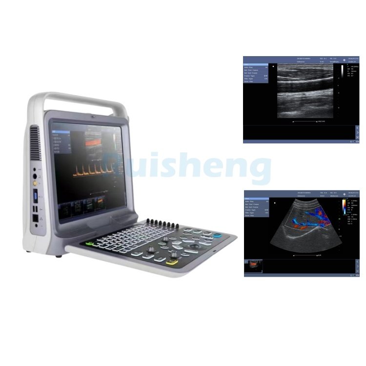 Color Doppler VET Ultrasound Scanner Medical Full Digital Ultra Sound Scan Machine ultrasonido For Animals