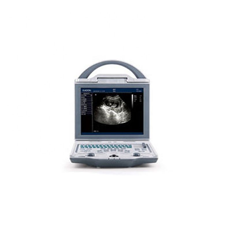 medical ultrasound instruments Small vet/veterinary ultrasound animals dog/horse usg machine price KX5600