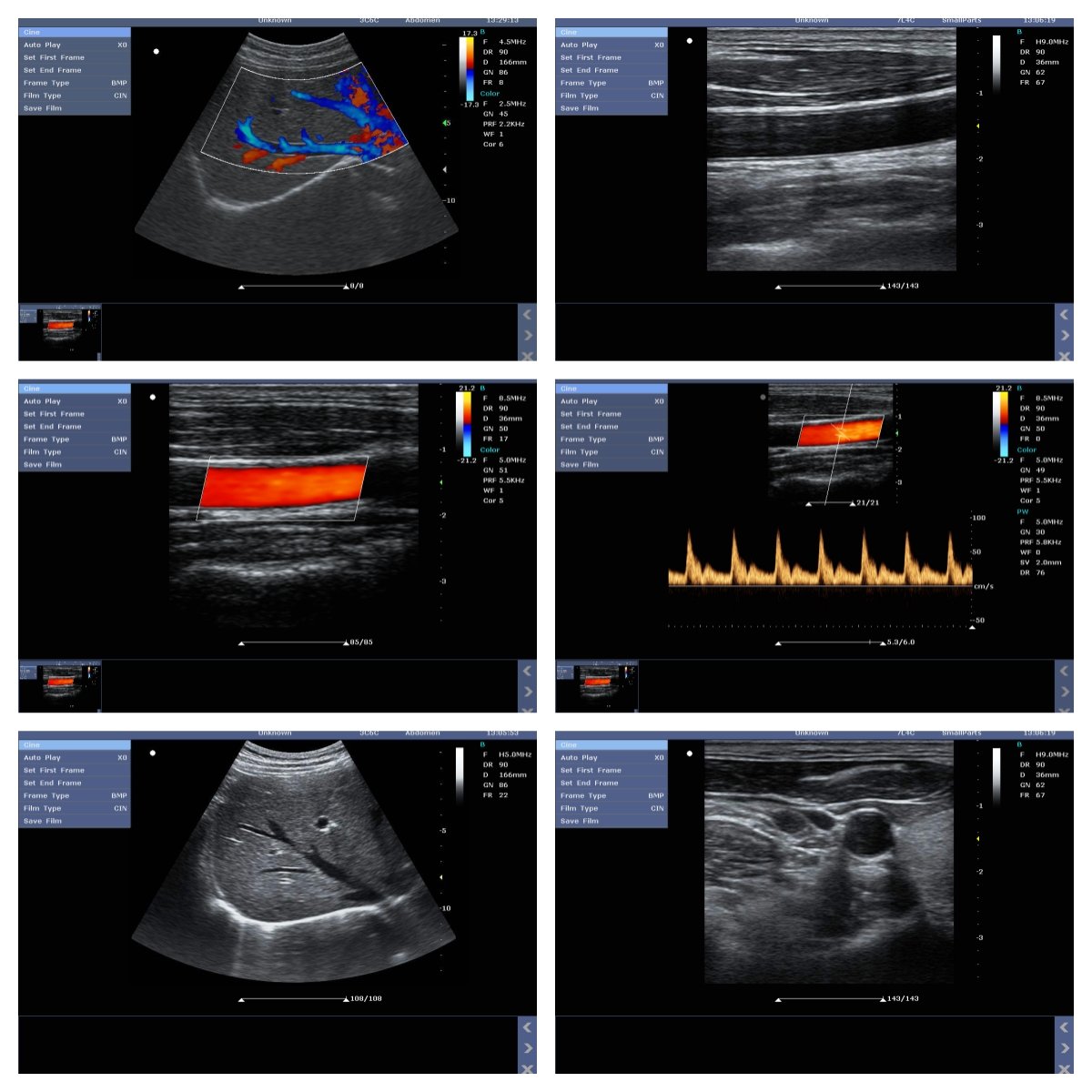Hospital Portable Color Doppler Ecograph Best Price 3d 4d Veterinary Portable Color Doppler Ultrasound