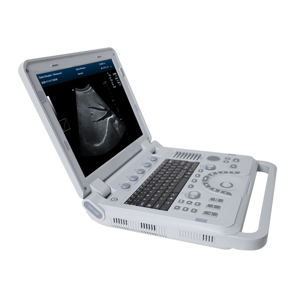 CONTEC CMS1700A ultrasound scanner cardiologycolor doppler medical ultrasound instruments ultrasound probe
