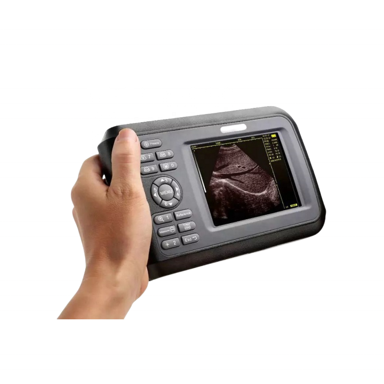 Low Price Handheld Portable Veterinary Ultrasound Scanner Farm Use Veterinary Equipment Bovine Equid Goat Pig Ultrasound Machine