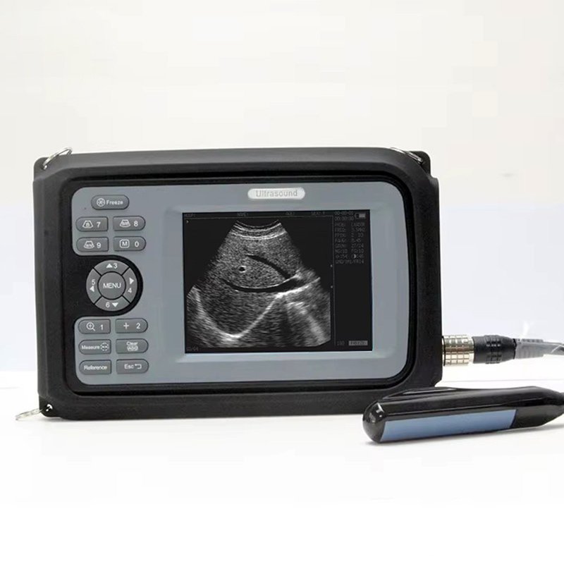 Handscan Ultrasound cheapest black and white Echocardiography Multiprobe medical instruments sonography human ultrasound machine