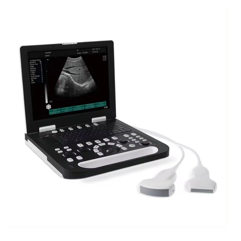 Portable Medical ultrasound instruments Human use Mindray Black and White ultrasound machine price veterinary Scanner