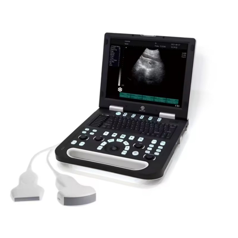 Portable Medical ultrasound instruments Human use Mindray Black and White ultrasound machine price veterinary Scanner