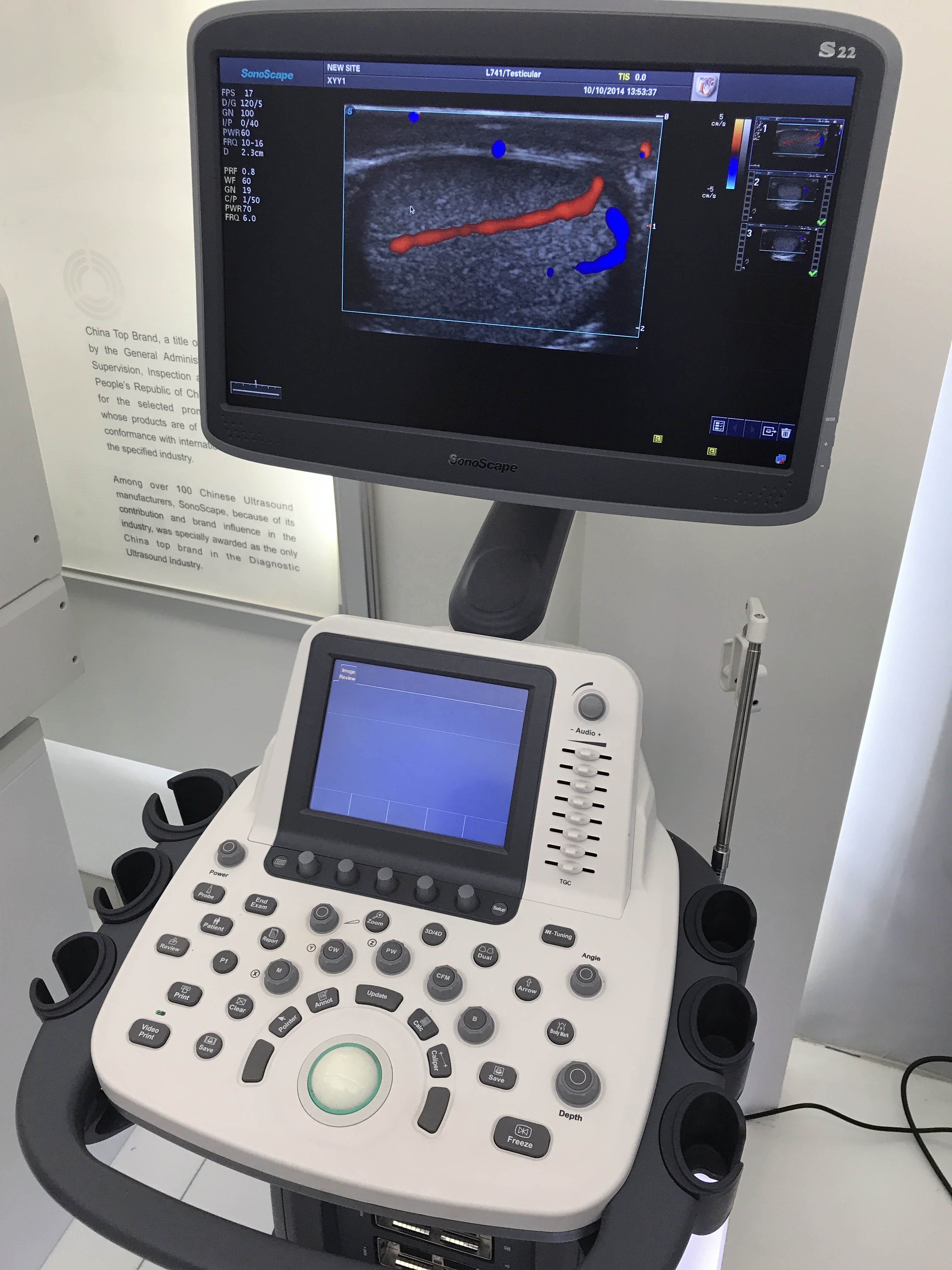 medical ultrasound instruments sonoscape s22 sonoscape ultrasound machine