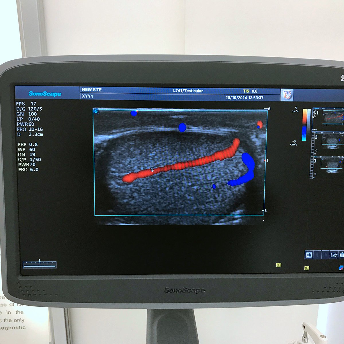 medical ultrasound instruments sonoscape s22 sonoscape ultrasound machine
