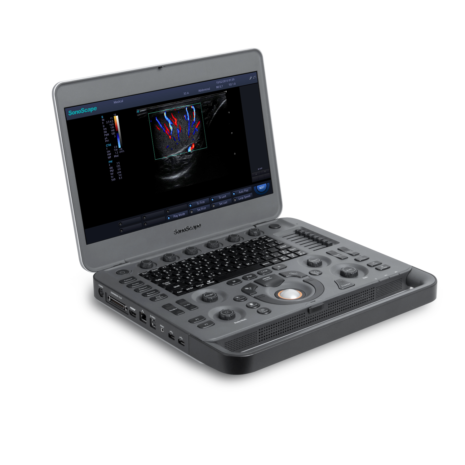 New 4D Ultrasound SonoScape X5&X5V & Sonoscape USG X series