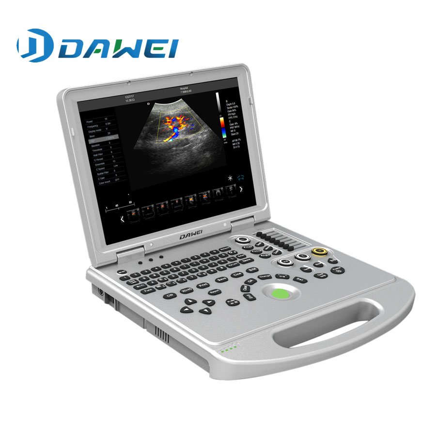 Laptop mobile Color doppler veterinary ultrasound China& ecografo portable china DW-VET8P